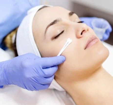 Chemical Peel