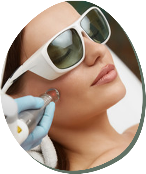 Laser Treatments